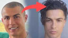 Cristiano Ronaldo Had a Hair Transplant!? Here is what I found!