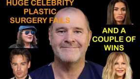 3 Huge Celebrity plastic surgery FAILS. And 2 successes.