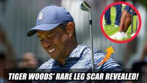 Tiger Woods' Leg Scar Revealed at Golf Tournament