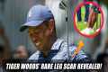 Tiger Woods' Leg Scar Revealed at