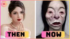 12 Celebrity Plastic Surgery Fails They Wish They Could Undo | Then and Now 2025