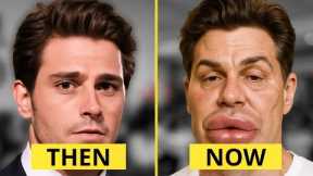 15 WORST Male Celebrity Plastic Surgery FAILS | Then and Now 2025