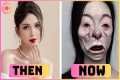 12 Celebrity Plastic Surgery Fails