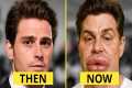 15 WORST Male Celebrity Plastic