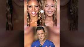 What plastic surgery has Beyonce had? #shorts