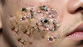 𝑨𝒄𝒉𝒊𝒆𝒗𝒆 𝑰𝒏𝒏𝒆𝒓 𝑷𝒆𝒂𝒄𝒆 𝑾𝒊𝒕𝒉 𝑻𝒉𝒆𝒔𝒆 𝑭𝒂𝒄𝒊𝒂𝒍 𝑪𝒍𝒆𝒂𝒏𝒔𝒊𝒏𝒈 𝑴𝒆𝒕𝒉𝒐𝒅𝒔 #801430