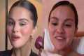 Selena Gomez ADDICTION To Fillers Is